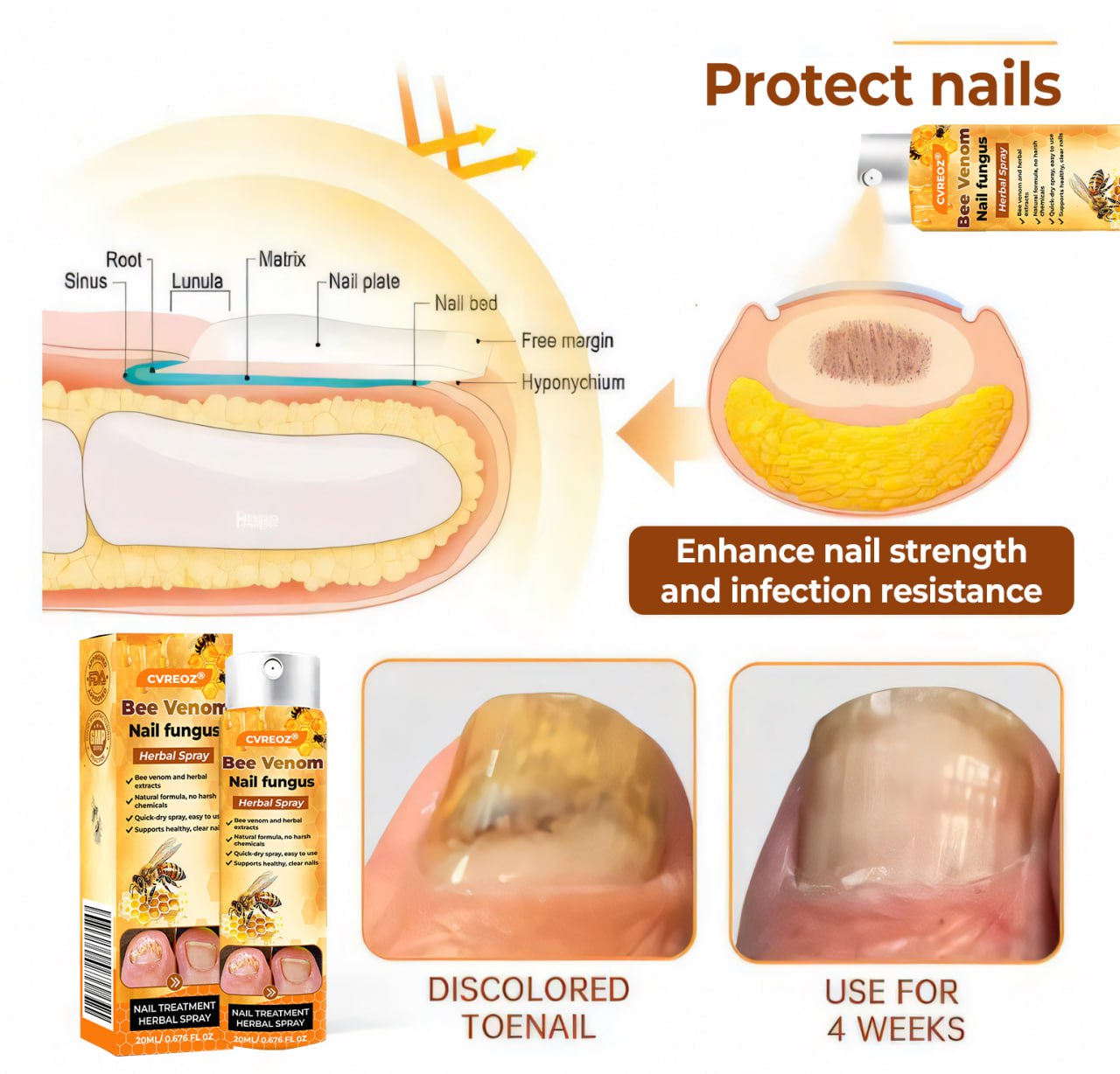 💥 2025 Limited 60% OFF ️⏳ Crveoz® Bee Venom Nail Fungus Herbal Spray