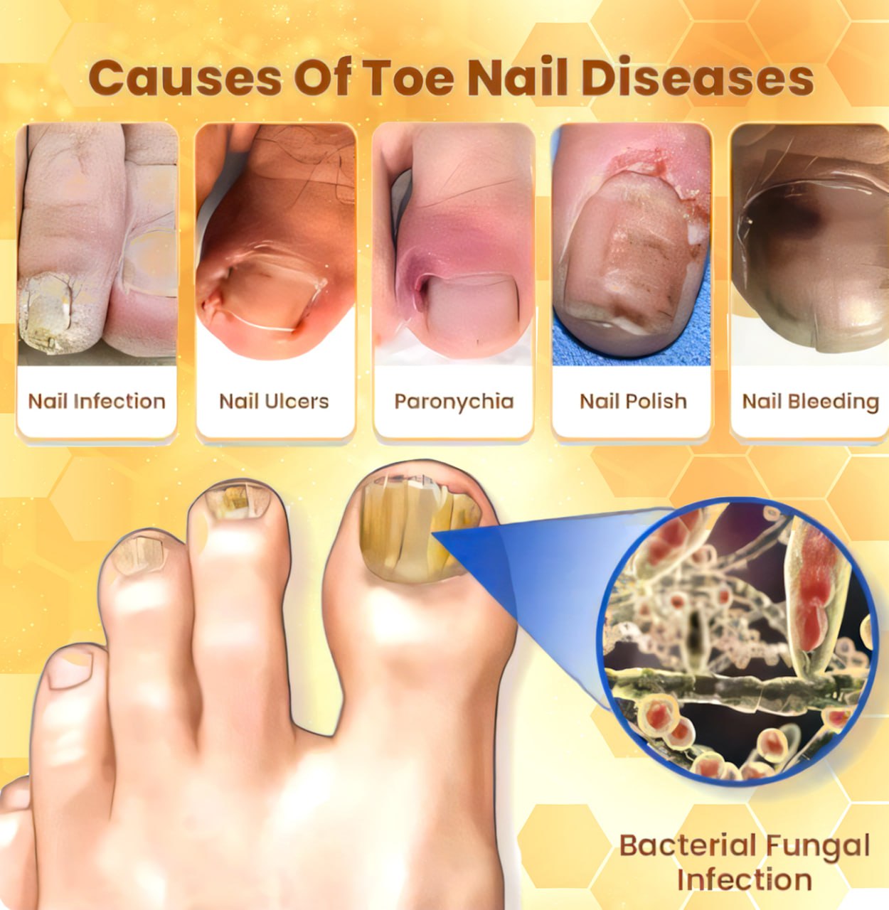 💥 2025 Limited 60% OFF ️⏳ Crveoz® Bee Venom Nail Fungus Herbal Spray