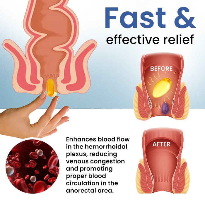 🔥LIMITED DEAL: 60% OFF🔥Cvreoz® Natural Hemorrhoid Capsules