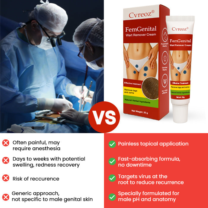 💥 2025 Limited OFFER 60% OFF ️⏳ Cvreoz® FemGenital Wart Remover Cream