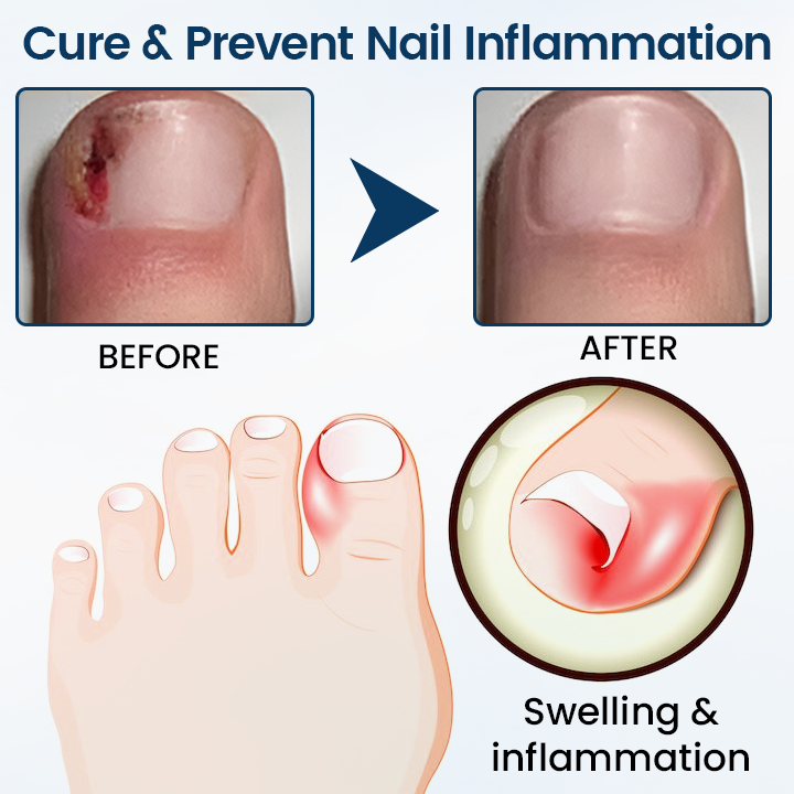 ⚡Final Chance: Save 60% Today Only🔥 Cvreoz® OnyxiGuard Fungal Repair Herbal Spray