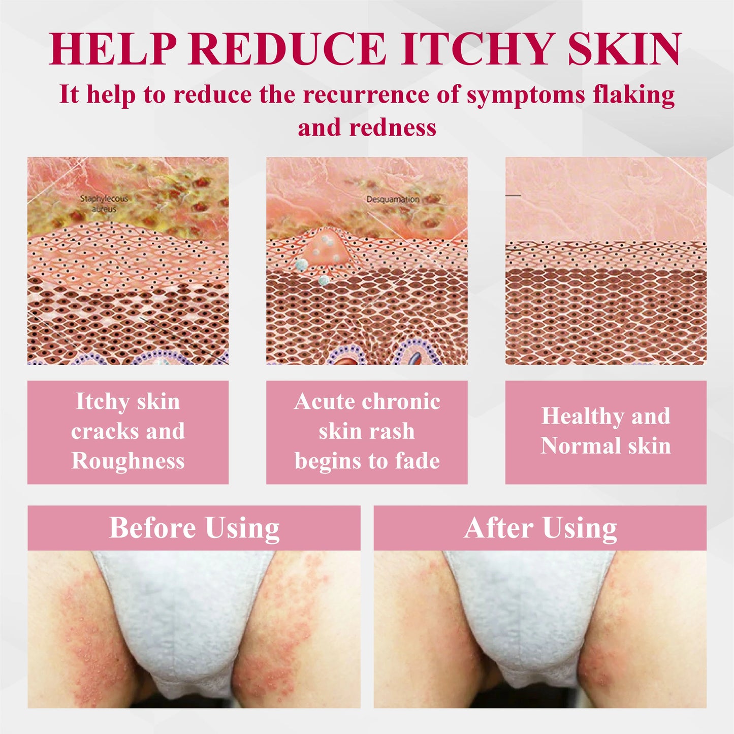 🔥 Special Deal: 60% OFF 🌸 CVREOZ® Woman's Genital HPV Healing Cream 🌸