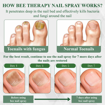 Cvreoz®  7 days Nail Fungus Renewal Herbal Spray🎁🎁