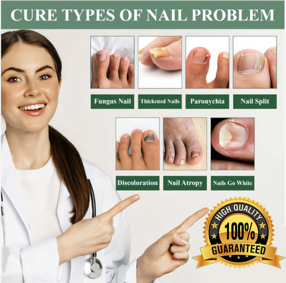 Cvreoz®  7 days Nail Fungus Renewal Herbal Spray🎁🎁