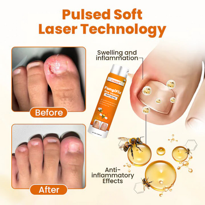 🧡 CVREOZ® FungiFix Bee Venom Nail Spray 🐝✨