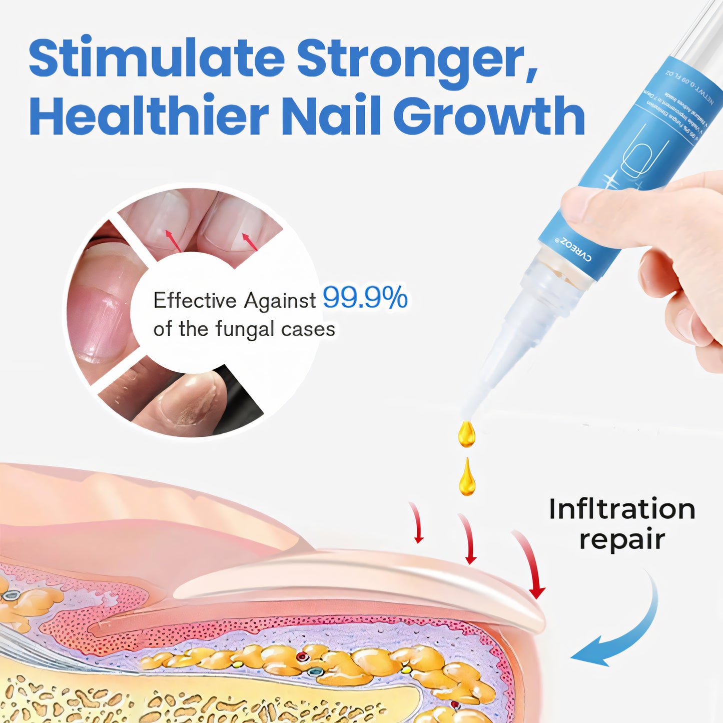💅🏻 CVREOZ® MycoClear Nail Repair Pen 🖋️ Hot Sale Up To 60% 🔥