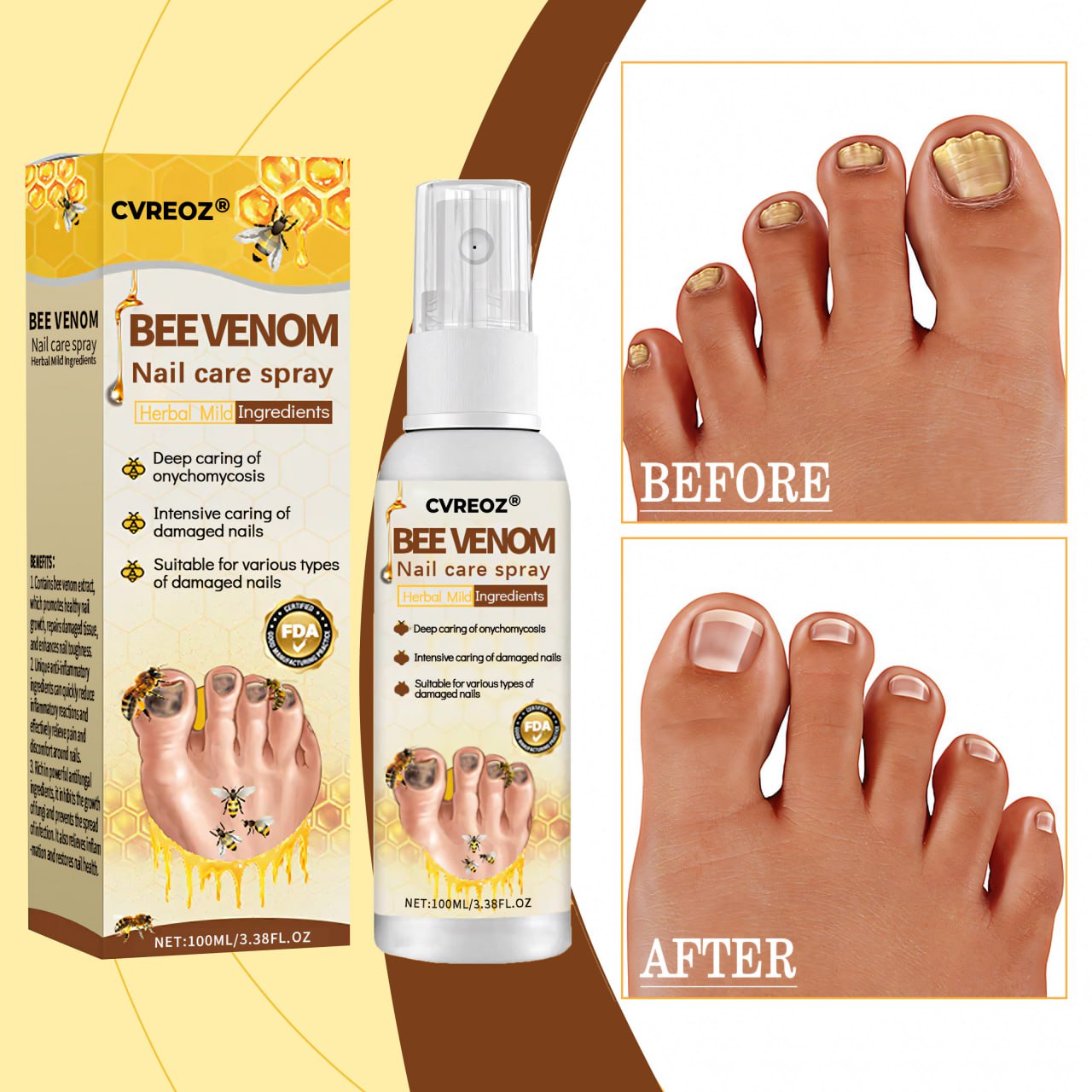 CVREOZ® Bee Venom Nail Fungus Care Spray