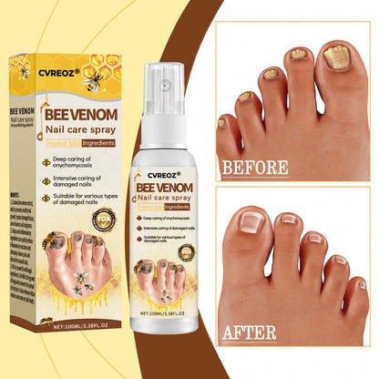 CVREOZ® Bee Venom Nail Fungus Care Spray