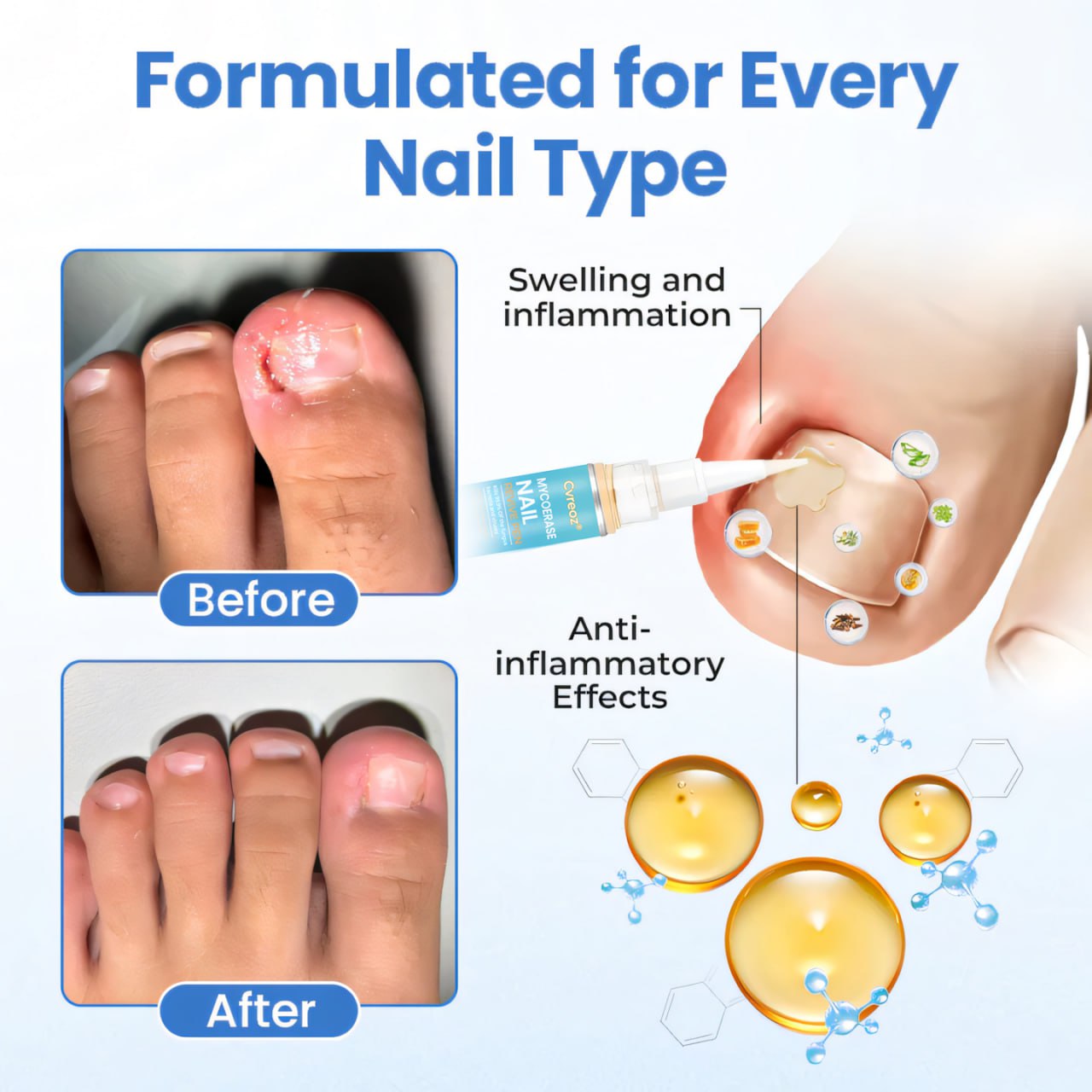 Cvreoz® MycoErase Nail Revive Pen⭐