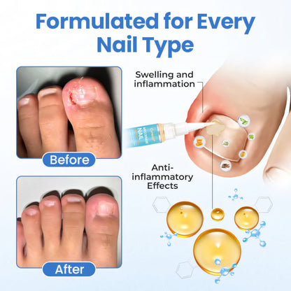 Cvreoz® MycoErase Nail Revive Pen⭐