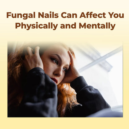 CVREOZ® Bee Venom Nail Fungus Care Spray