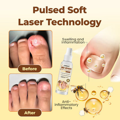 CVREOZ® Bee Venom Nail Fungus Care Spray