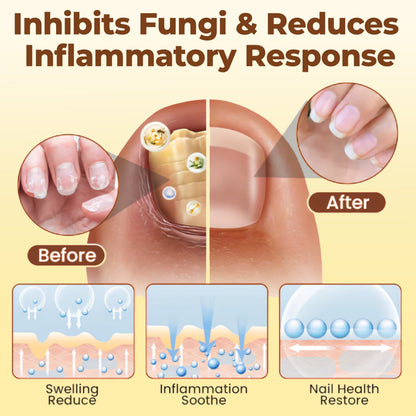 CVREOZ® Bee Venom Nail Fungus Care Spray