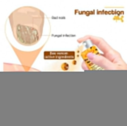 💥 2025 Limited 60% OFF ️⏳ Crveoz® Bee Venom Nail Fungus Herbal Spray