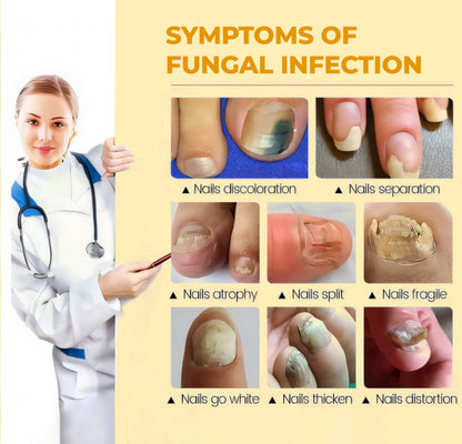 💥 2025 Limited 60% OFF ️⏳ Crveoz® Bee Venom Nail Fungus Herbal Spray