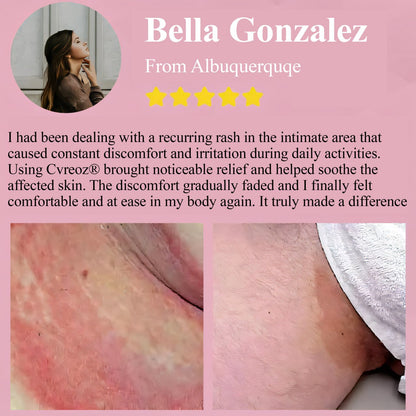 🔥 Special Deal: 60% OFF 🌸 CVREOZ® Woman's Genital HPV Healing Cream 🌸