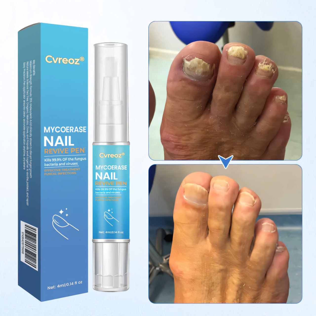 Cvreoz® MycoErase Nail Revive Pen⭐